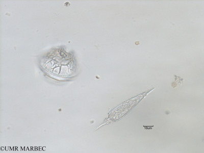 phyto/Bizerte/bizerte_bay/RISCO November 2015/Goniodoma spp et Oxytoxum scolopax (Baie_T5-C2-Gonyaulax a identifer et oxytoxum long-12).tif(copy)_thumb.jpg